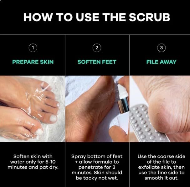 Dermasuri Callus Remover Foot Scrub with Exfoliating Spray and Reusable Sole File - Dead Skin Remover for Cracked Heels - Deluxe Pedicure Spa Kit Avelisse