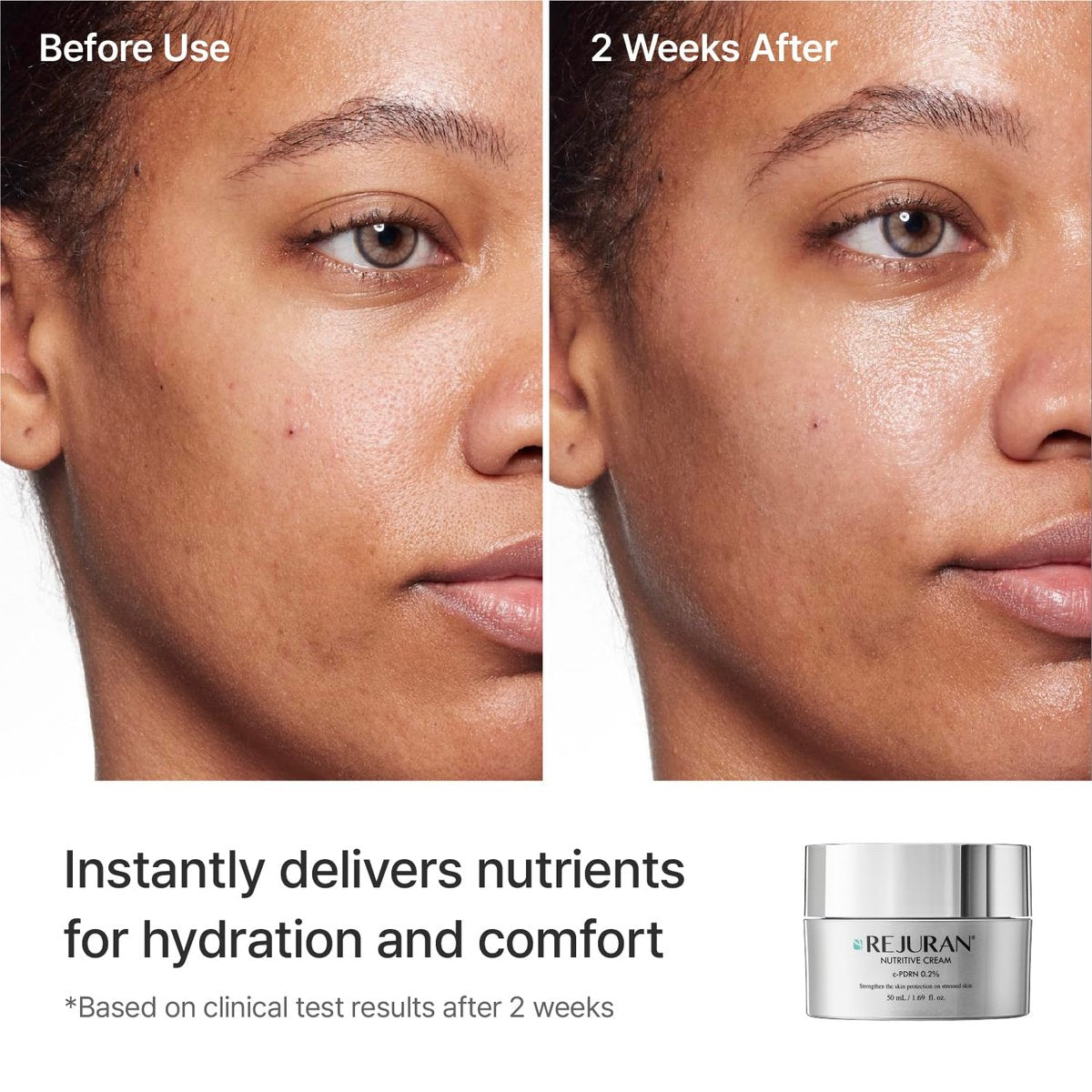 REJURAN Nutritive Cream with c-PDRN – Salmon DNA Facial Moisturizer for Nourishing, Deep Hydrating, Radiant Glass Skin – Korean Skincare, 1.69 fl oz Avelisse
