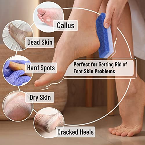 Slick Pumice Stone for Feet - 4 Pack Callus Remover, Foot Scrub for Pedicure, Dead Skin Remover - görsel 10