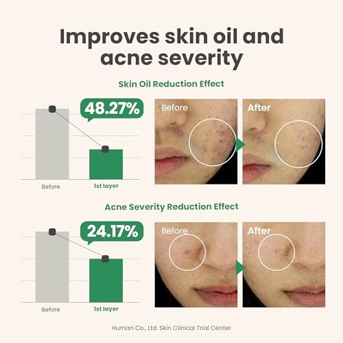AXIS-Y Spot The Difference Blemish Spot Treatment - 4-Terpineol 2% Niacinamide AHA BHA Soothes Breakouts & Skin Barrier Repair - Vegan Korean Skin Care Face Serum (0.50 fl. oz.) Avelisse