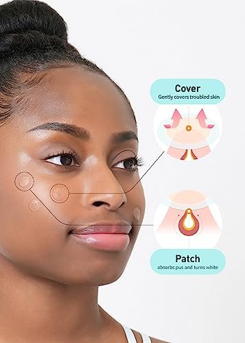 OLIVE YOUNG Care Plus Spot Patch Big (81 Count) - Hydrocolloid Acne Pimple Patches for Blemishes and Zits Avelisse