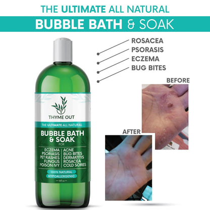 All Natural Organic Plant Based Bubble Bath – Hypoallergenic Skin-Soothing Thyme Eczema Bath Soak with Colloidal Oatmeal – Sensitive Skin Bubble Bath for Kids & Adults – 16 oz Avelisse