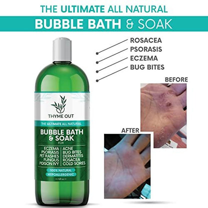 All Natural Organic Plant Based Bubble Bath – Hypoallergenic Skin-Soothing Thyme Eczema Bath Soak with Colloidal Oatmeal – Sensitive Skin Bubble Bath for Kids & Adults – 16 oz Avelisse