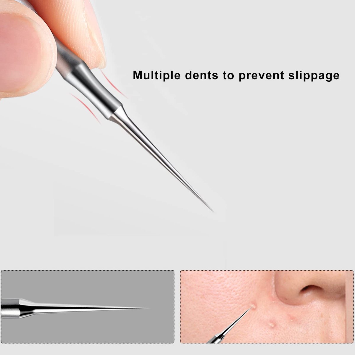 2-in-1 Acne Extractor Tool - Stainless Steel Blackhead & Whitehead Remover for Face and Nose | Jaxiria - görsel 3
