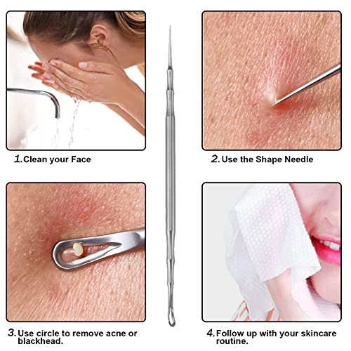 2-in-1 Acne Extractor Tool - Stainless Steel Blackhead & Whitehead Remover for Face and Nose | Jaxiria - görsel 8