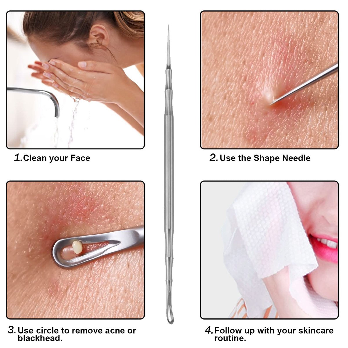 2-in-1 Acne Extractor Tool - Stainless Steel Blackhead & Whitehead Remover for Face and Nose | Jaxiria - görsel 7