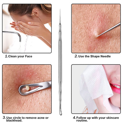 2-in-1 Acne Extractor Tool - Stainless Steel Blackhead & Whitehead Remover for Face and Nose | Jaxiria