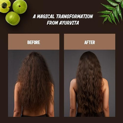 AyurVita Restorative Hair Oil - Amla & Neem for Strengthening, Dryness & Dandruff - Promotes Hair Growth - Men & Women - 2 fl oz