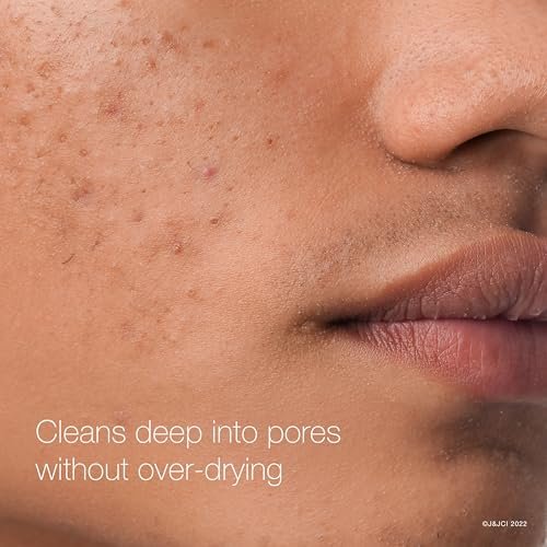 Neutrogena Rapid Clear Maximum Strength Acne Face Pads with 2% Salicylic Acid, Oil-Free, 60 Count (Pack of 3) Avelisse