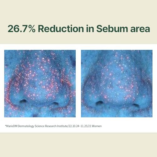 Pyunkang Yul Calming Moisture Serum – Daily Hydration & Soothing Care with Centella Asiatica, Tea Tree, 5 Hyaluronic Acids & Ceramide Avelisse