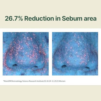 Pyunkang Yul Calming Moisture Serum – Daily Hydration & Soothing Care with Centella Asiatica, Tea Tree, 5 Hyaluronic Acids & Ceramide Avelisse