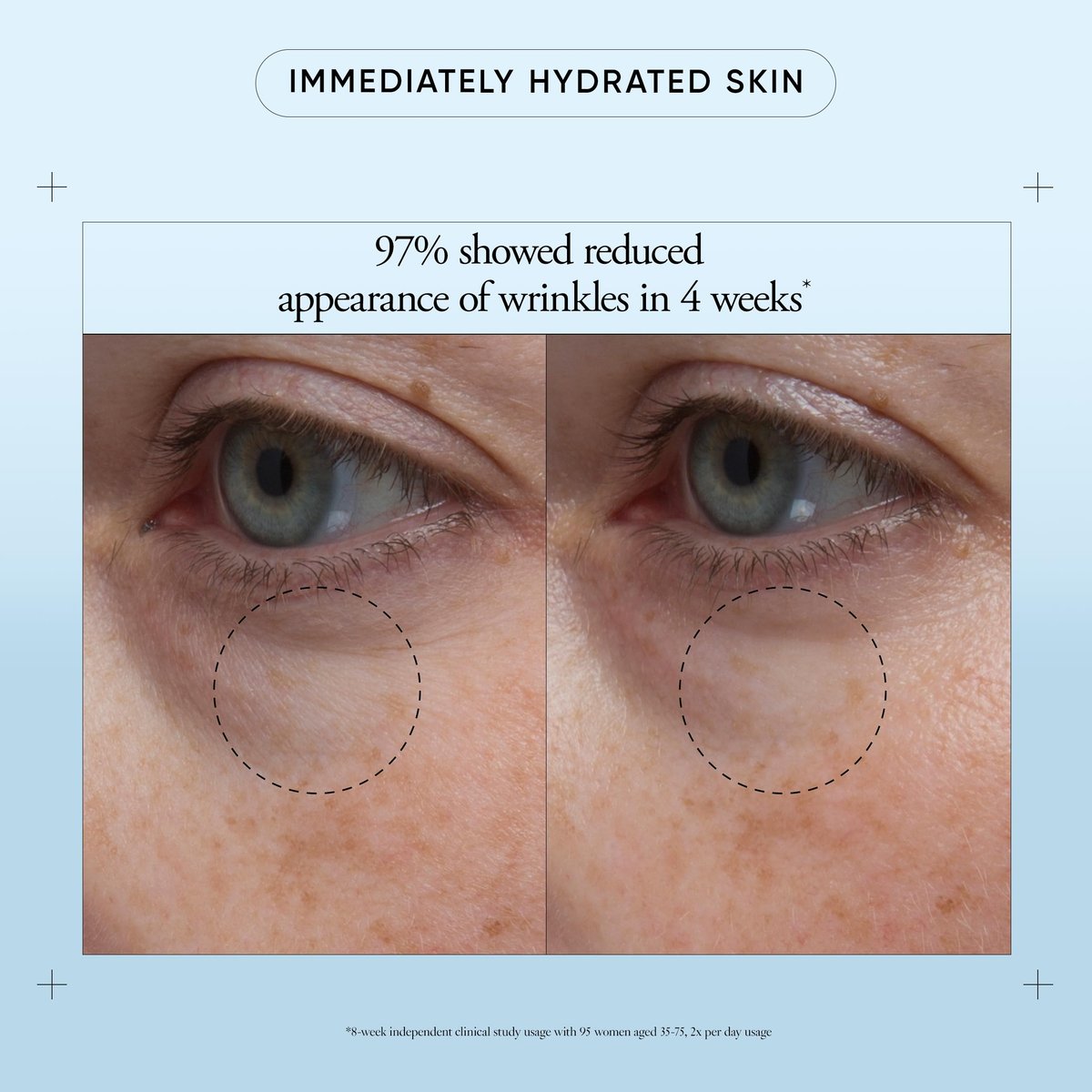 Philosophy Hope in a Jar Eye Revival Serum Eye Cream - Hydrating and Depuffing Eye Treatment with Hyaluronic Acid, Elderberry & Tangerine Peel Extract - 0.5 fl oz Avelisse
