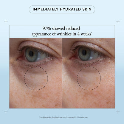 Philosophy Hope in a Jar Eye Revival Serum Eye Cream - Hydrating and Depuffing Eye Treatment with Hyaluronic Acid, Elderberry & Tangerine Peel Extract - 0.5 fl oz Avelisse