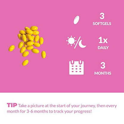 UpNourish Hair Growth Vitamins for Women - Proven Formula with KERANAT, DHT Blocker PHYTOPIN, Biotin 5000 mcg & SOD - 90 Count Avelisse