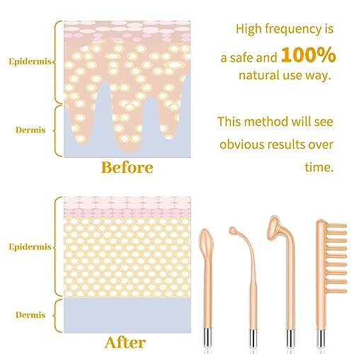 MYSWEETY High Frequency Portable Handheld Facial Skin Care Wand Machine - Orange Glass Electrode Avelisse