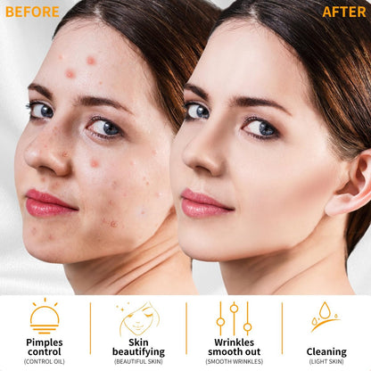 MYSWEETY High Frequency Portable Handheld Facial Skin Care Wand Machine - Orange Glass Electrode Avelisse