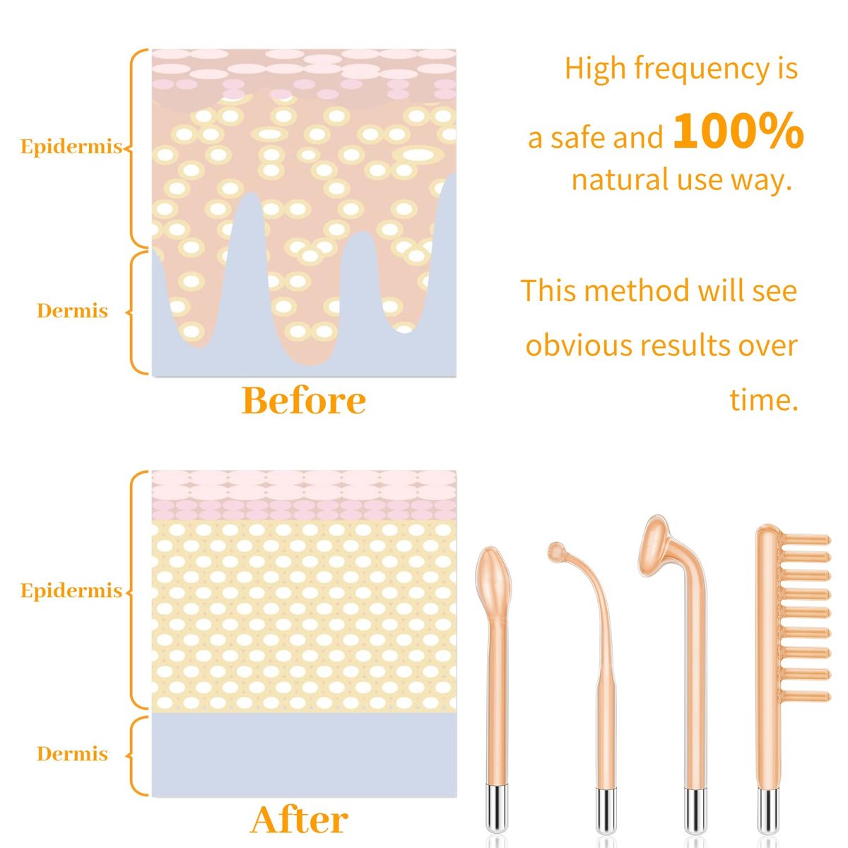 MYSWEETY High Frequency Portable Handheld Facial Skin Care Wand Machine - Orange Glass Electrode Avelisse