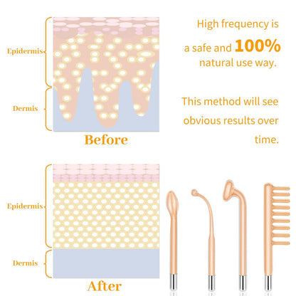 MYSWEETY High Frequency Portable Handheld Facial Skin Care Wand Machine - Orange Glass Electrode Avelisse