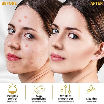 MYSWEETY High Frequency Portable Handheld Facial Skin Care Wand Machine - Orange Glass Electrode Avelisse