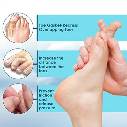 Kimihome 12 Pack Foam Toe Separators - Relieve Bunion Pain, Correct Overlapping Toes, Prevent Friction