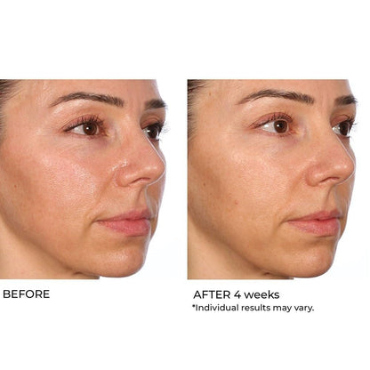 NassifMD Hydro-Gel with Hyaluronic Acid Moisturizer, Salicylic Acid Serum, Retinol Serum for Face