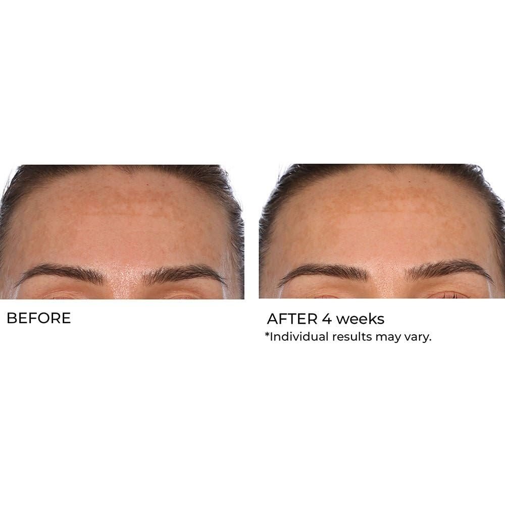 NassifMD Hydro-Gel with Hyaluronic Acid Moisturizer, Salicylic Acid Serum, Retinol Serum for Face - görsel 11