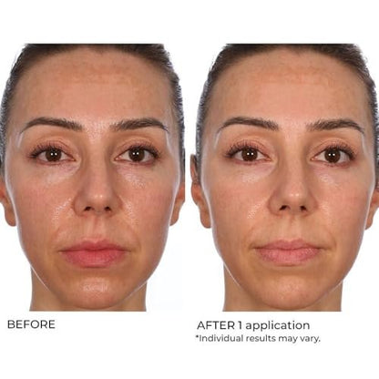 NassifMD Hydro-Gel with Hyaluronic Acid Moisturizer, Salicylic Acid Serum, Retinol Serum for Face