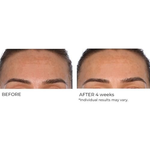 NassifMD Hydro-Gel with Hyaluronic Acid Moisturizer, Salicylic Acid Serum, Retinol Serum for Face - görsel 12