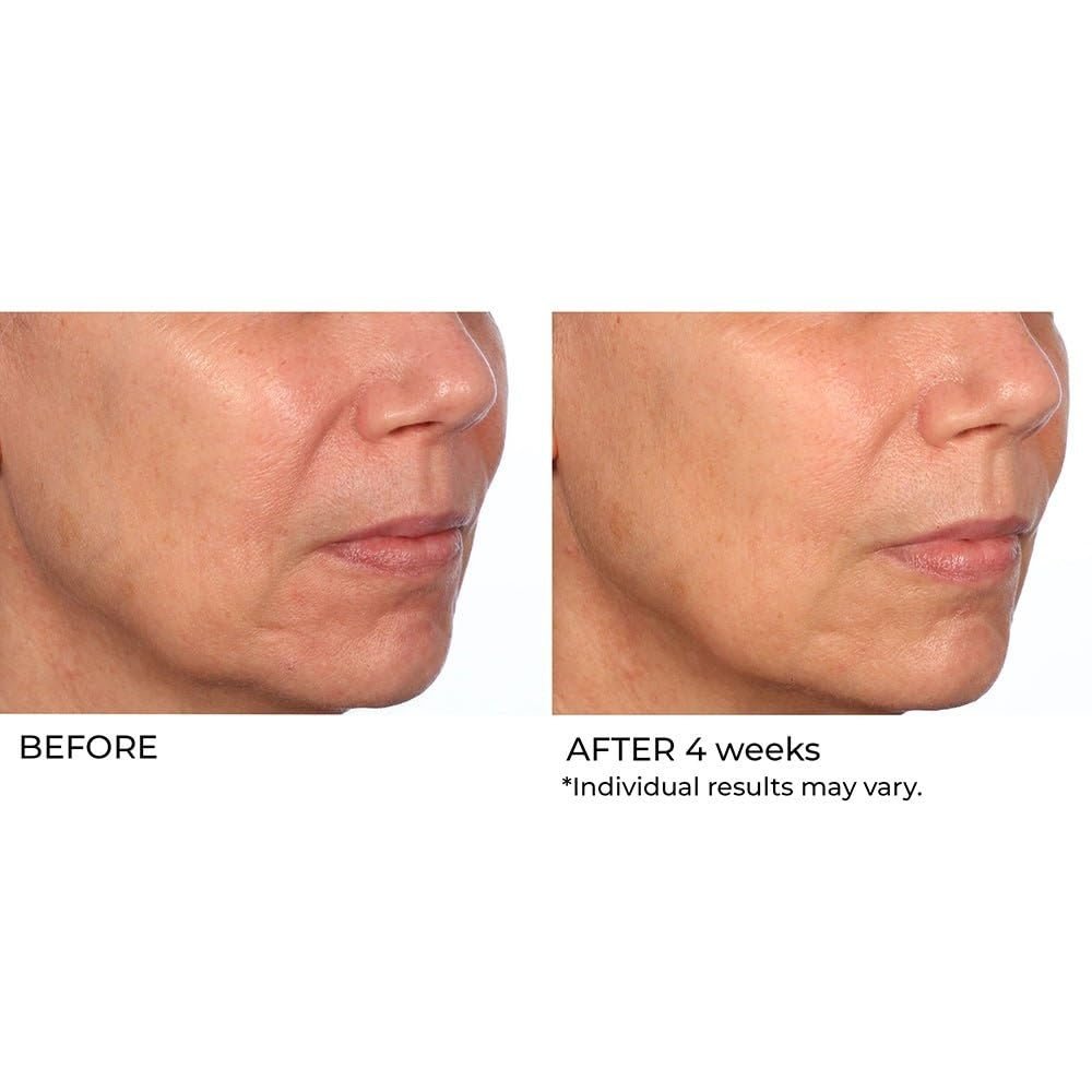 NassifMD Hydro-Gel with Hyaluronic Acid Moisturizer, Salicylic Acid Serum, Retinol Serum for Face - görsel 13