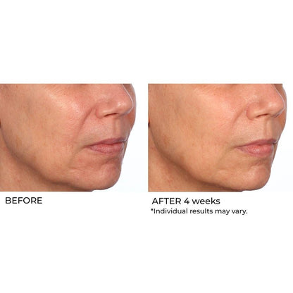 NassifMD Hydro-Gel with Hyaluronic Acid Moisturizer, Salicylic Acid Serum, Retinol Serum for Face