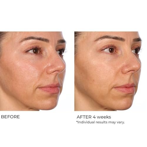 NassifMD Hydro-Gel with Hyaluronic Acid Moisturizer, Salicylic Acid Serum, Retinol Serum for Face - görsel 10