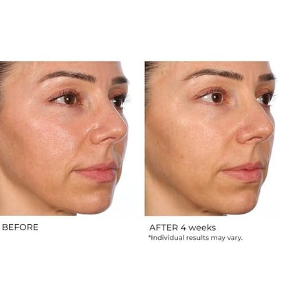 NassifMD Hydro-Gel with Hyaluronic Acid Moisturizer, Salicylic Acid Serum, Retinol Serum for Face