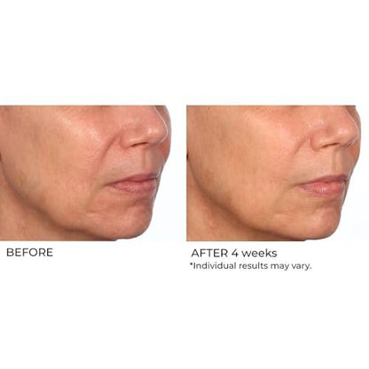 NassifMD Hydro-Gel with Hyaluronic Acid Moisturizer, Salicylic Acid Serum, Retinol Serum for Face