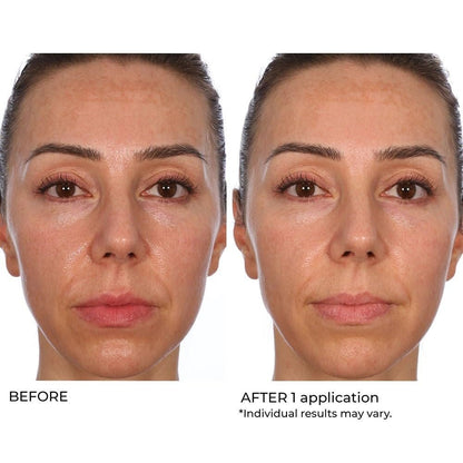 NassifMD Hydro-Gel with Hyaluronic Acid Moisturizer, Salicylic Acid Serum, Retinol Serum for Face