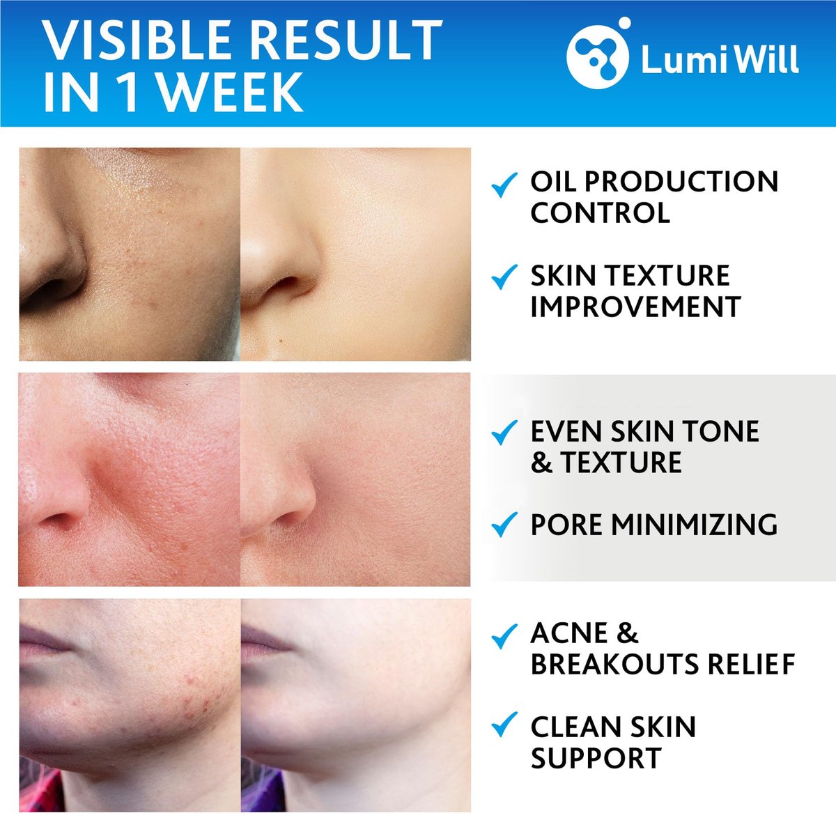 LUMI WILL Glycolic Acid Pads 35% – Exfoliating Face Pads with Vitamins B5, C, E & Green Tea – Resurfacing Acid Exfoliator for Uneven Tone & Texture – At-Home Chemical Exfoliant for Face – 50 Pre-Soaked Pads Avelisse