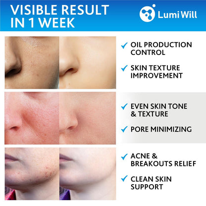 LUMI WILL Glycolic Acid Pads 35% – Exfoliating Face Pads with Vitamins B5, C, E & Green Tea – Resurfacing Acid Exfoliator for Uneven Tone & Texture – At-Home Chemical Exfoliant for Face – 50 Pre-Soaked Pads Avelisse