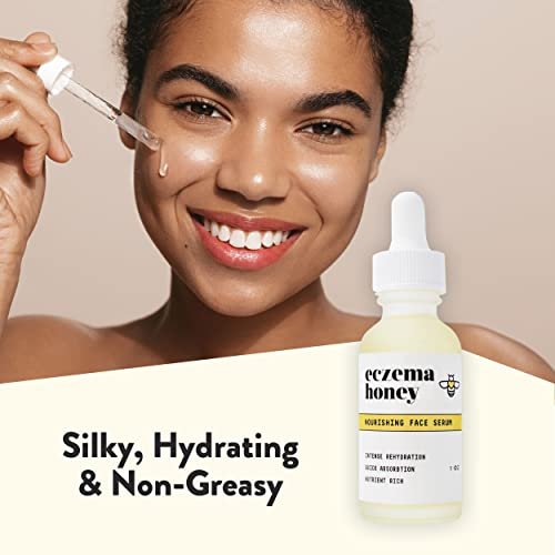 ECZEMA HONEY Nourishing Face Serum - Daily Hydrating Serum for Eczema, Dry & Sensitive Skin (1 Oz) Avelisse