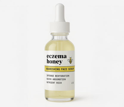 ECZEMA HONEY Nourishing Face Serum - Daily Hydrating Serum for Eczema, Dry & Sensitive Skin (1 Oz) Avelisse