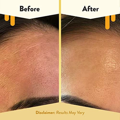 ECZEMA HONEY Oatmeal Facial Cleanser - Natural Eczema Face Wash for Dry, Itchy, Sensitive Skin - Gentle Daily Cleanser Prevents Breakouts (6 Oz)