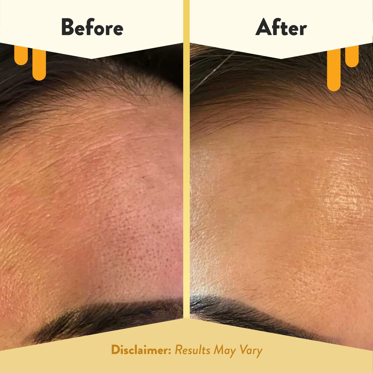 ECZEMA HONEY Oatmeal Facial Cleanser - Natural Eczema Face Wash for Dry, Itchy, Sensitive Skin - Gentle Daily Cleanser Prevents Breakouts (6 Oz) - görsel 7