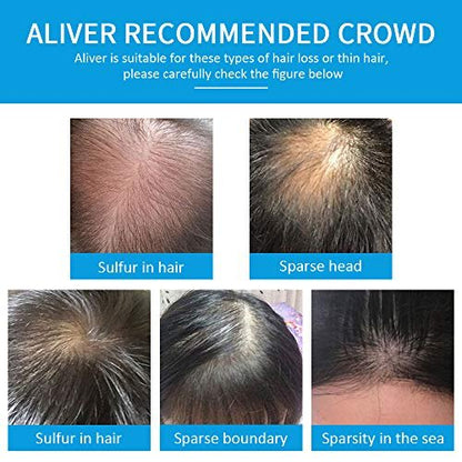 ELAIMEI Black Hair Fibers for Thinning Hair - Natural Unscented Powder for Men & Women (Black, 0.97 oz)