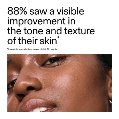 The INKEY List 15% Vitamin C and EGF Serum – 1 Fl Oz, Reduces Hyperpigmentation, Rejuvenating Serum for All Skin Types, Vegan