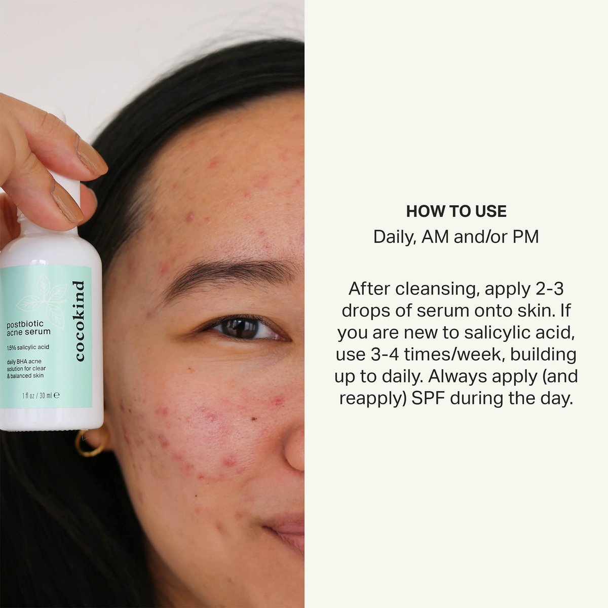 Cocokind Postbiotic Acne Serum with Salicylic Acid - BHA Liquid Exfoliant for Acne-Prone Skin, Brightening & Hydrating Face Serum, 1 Fl Oz - görsel 7