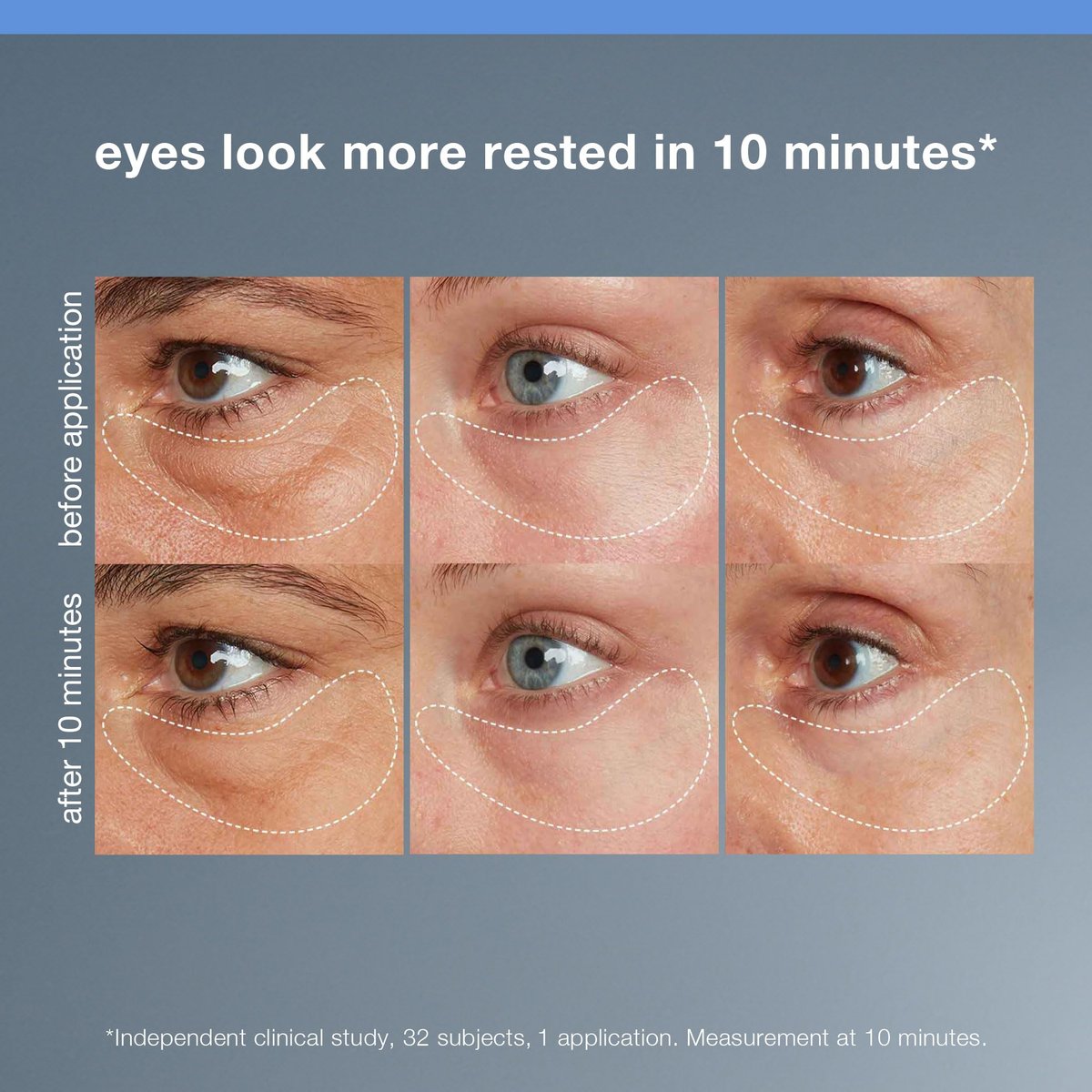 Dermalogica Awaken Peptide Eye Gel – Reduce Puffiness & Wrinkles Avelisse