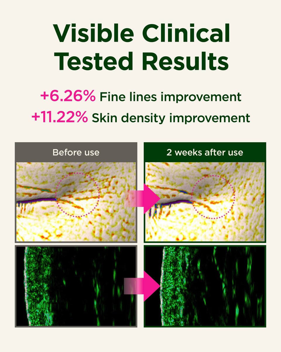 CKD Retino Collagen First Essence - Daily Face Deep Hydration Essence for Firming, Exfoliation, and Smoother Skin Texture. Collagen Boosting and Youthful Skin. Korean Skin Care. 5.07 fl oz - görsel 7
