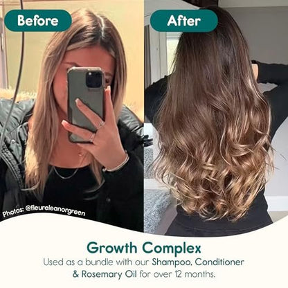 Nature Spell Hair Growth Complex Shampoo, Sulfate & Paraben Free, Nourishing & Strengthening, Infused with Hyaluronic Acid & Vitamin B5, For All Hair Types, Vegan, 10.14 fl oz Avelisse