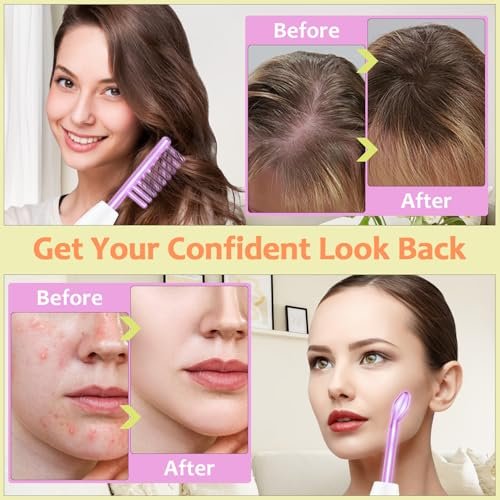 Uaike 4 in 1 High Frequency Facial Wand - Violet Portable Handheld Skin Device with 4 Purple Glass Tubes Avelisse
