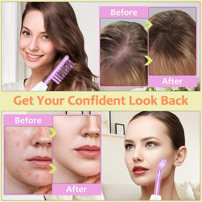 Uaike 4 in 1 High Frequency Facial Wand - Violet Portable Handheld Skin Device with 4 Purple Glass Tubes Avelisse