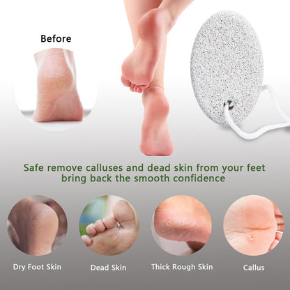 4-Pack Natural Pumice Stone for Feet - Borogo Lava Pedicure Tools, Hard Skin & Callus Remover for Feet, Hands, Heels, Elbows