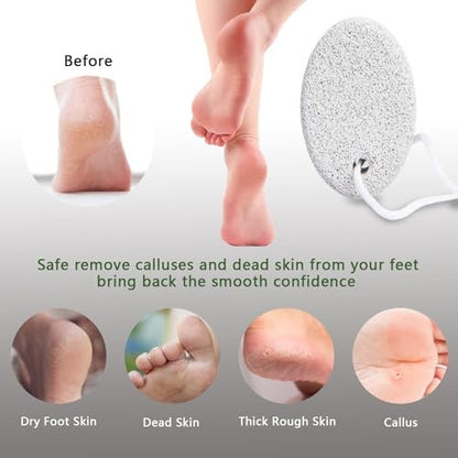 4-Pack Natural Pumice Stone for Feet - Borogo Lava Pedicure Tools, Hard Skin & Callus Remover for Feet, Hands, Heels, Elbows